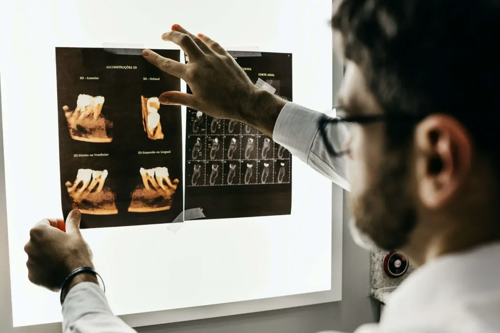 dental xrays